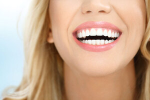 4 of the latest teeth whitening patents to brighten your smile