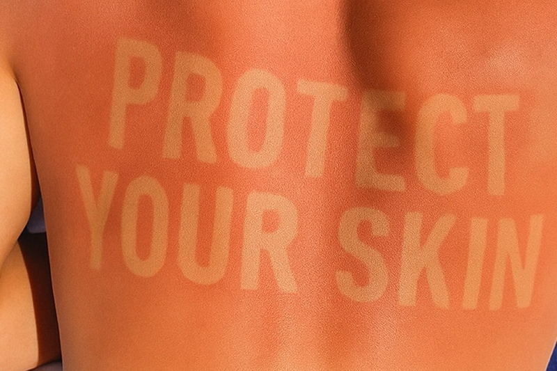 Tanned and burned back with words in skin tone that say protect your skin