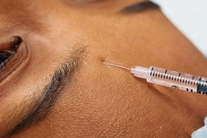 88% of London clinics flout Botox advertising regulations, study finds
