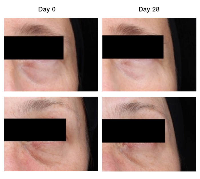 Active ingredient Neurophroline blocks stress hormone to control skin