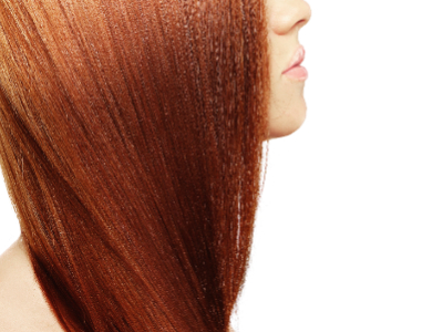 Activity vs androgenic alopecia
