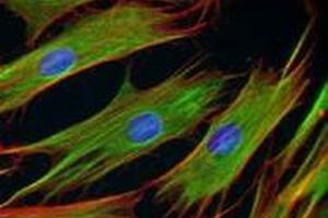 Advancell Toxicity