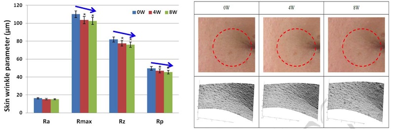 Figure 3. Anti-Wrinkle effects of Akebisol
