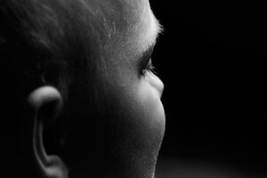 Allergan buys UK firm behind ear correction device earFold 