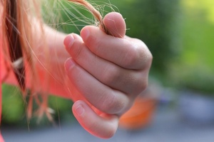 Alopecia sufferers at increased risk of depression 
