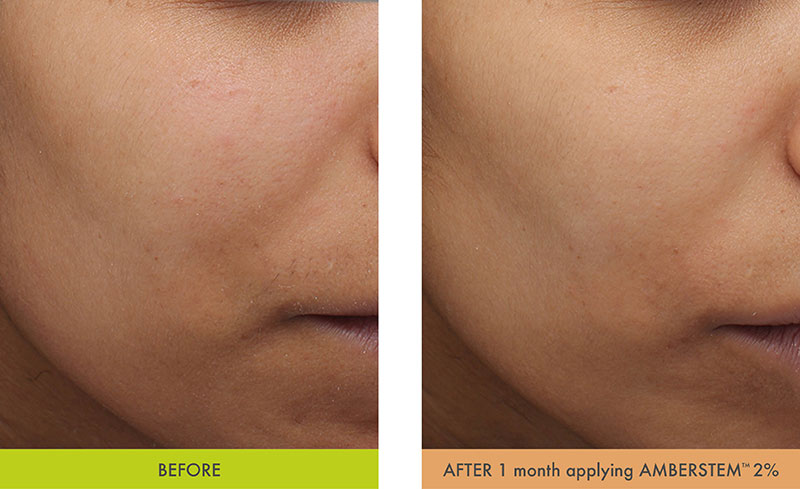 Amberstem - Beautiful lucency for olive complexions