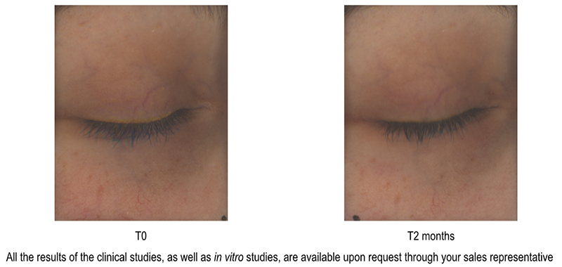 Ameyezing: The amazing bioconcealer for naturally brighter eyes
