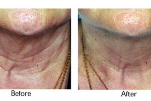 Anti-ageing technology focuses on calcium