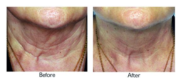 Anti-ageing technology focuses on calcium