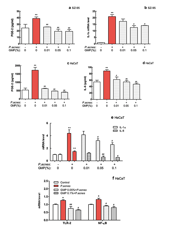 Antibacterial, anti-keratinised and anti-inflammatory effects of the GMP, a multi-herb extraction on acne vulgaris