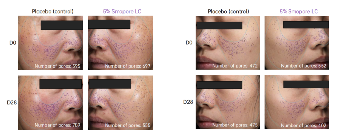 An SCI article about pore minimisation Published by JAKA independently