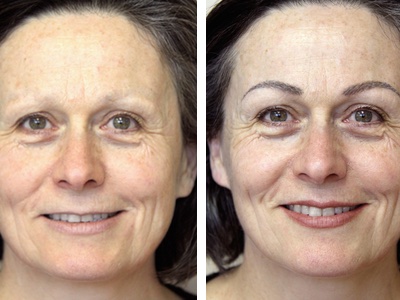 Before and after images from Cosmetic Transformations; subject: Helene Wood; artist: Kyla Gutsche