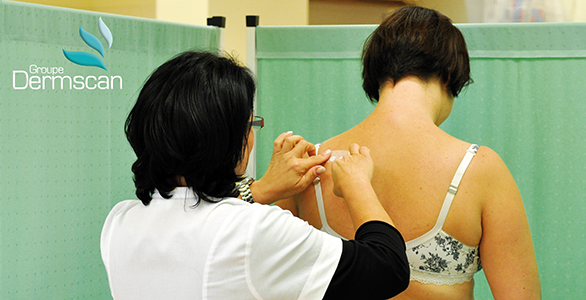 Dermscan introduces HRIPT under dermatological control
