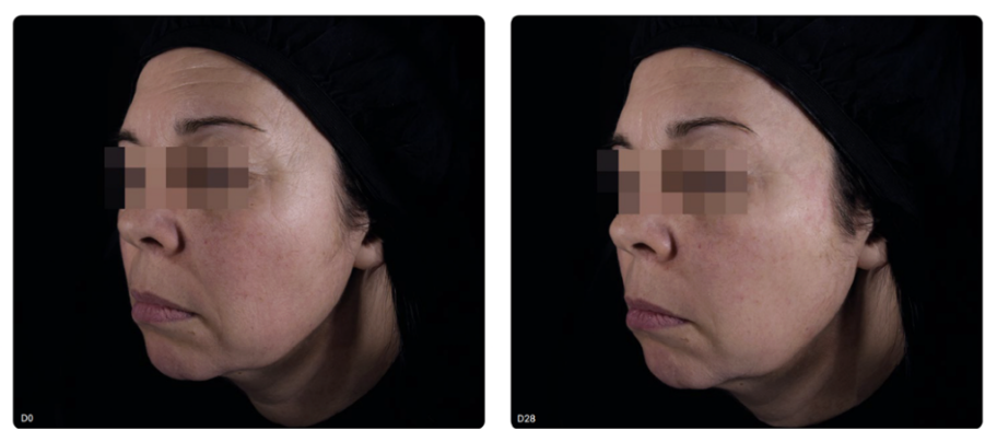 Epigenetic well-aging, a new pathway for skin longevity