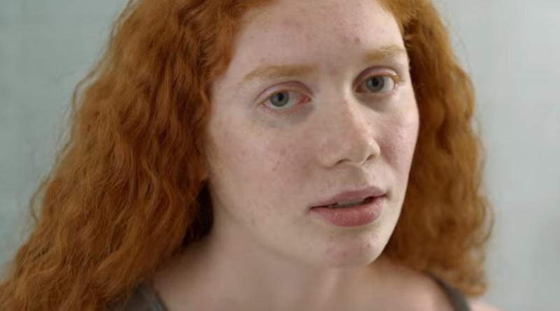 La Roche-Posay highlights impact of skin issues on mental health in first-ever TV brand campaign
