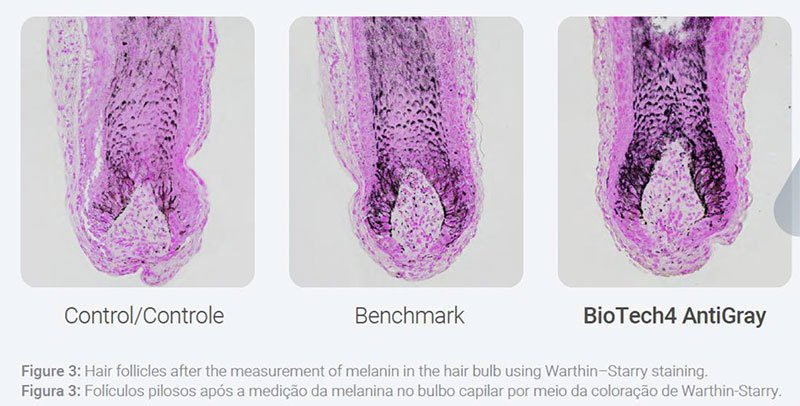 New Postbiotic Biotechnology Stimulates Natural Melanin and Helps Reverse Hair Graying