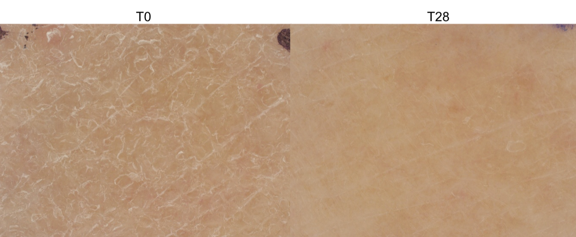 SphingoCare DS-Ceramix V - Bio-designed barrier and moisture reinforcement for sensitive skin