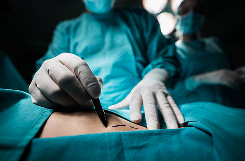 Asia Pacific - Thailand: Cosmetic Procedures Market Report 2017
