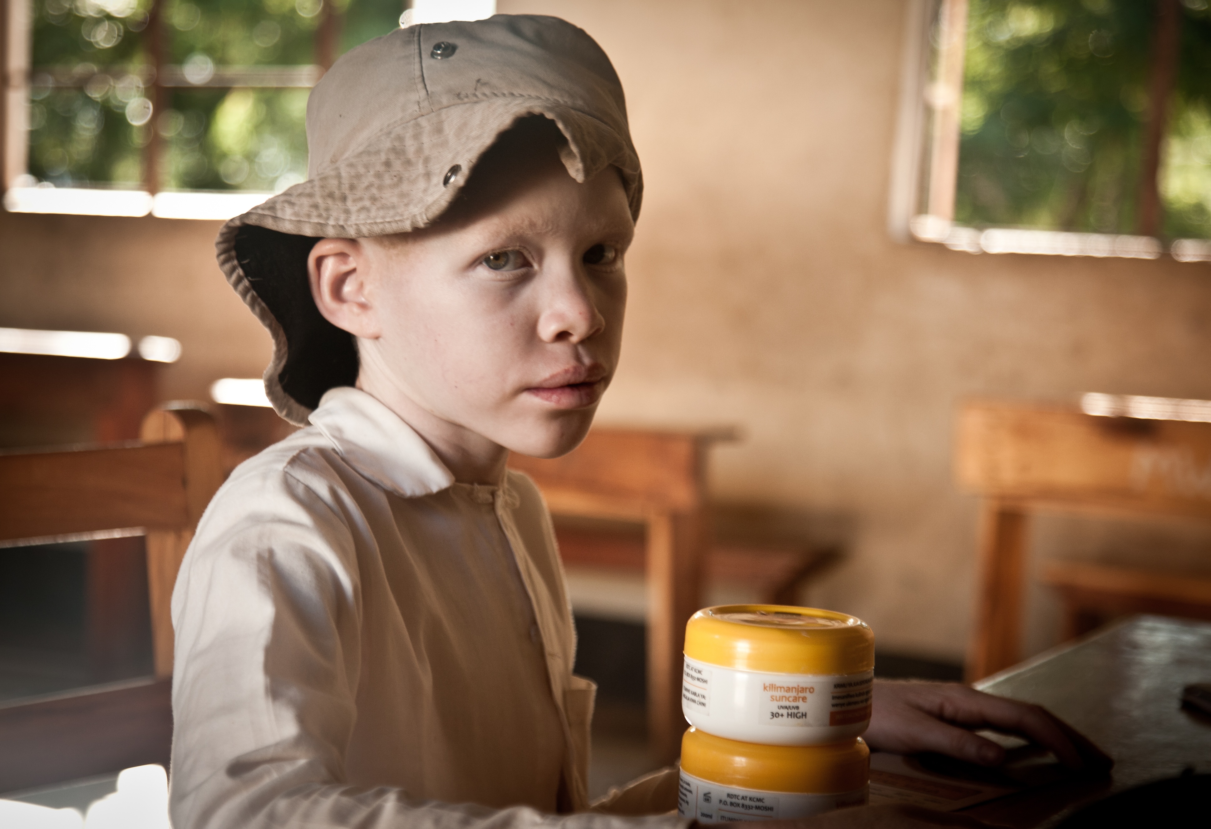 BASF aids albinos in Tanzania