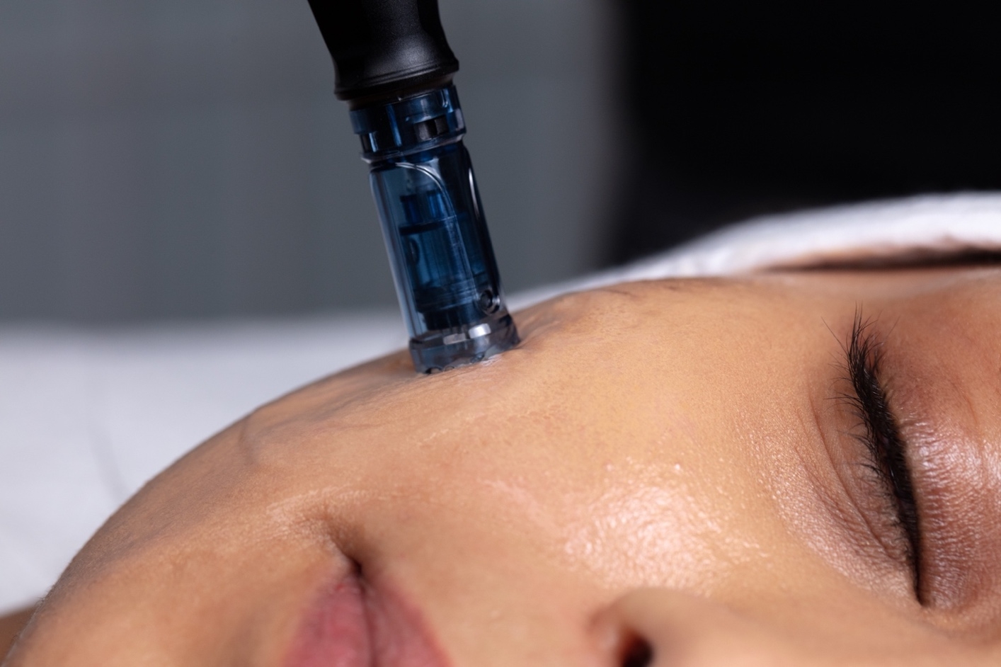 BEAUTYLAB launches new Microneedling Pen System