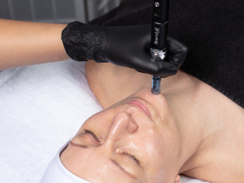 BEAUTYLAB launches peeling and needling webinar