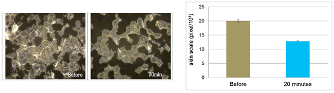 Figure 4. Clinical Study of BioDTox on skin scaling.