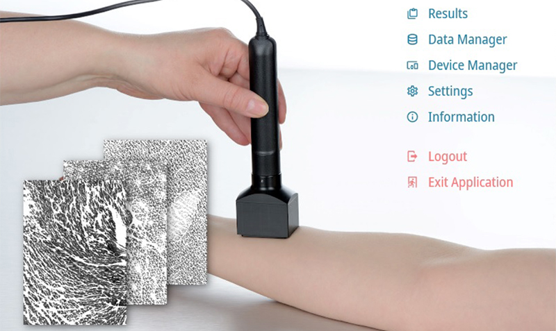 Capacitance imaging new MoistureMap MM 200