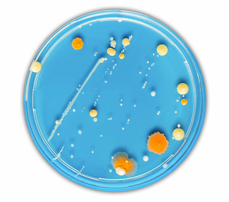 Charles River’s MALDI-TOF ID service now includes filamentous fungi