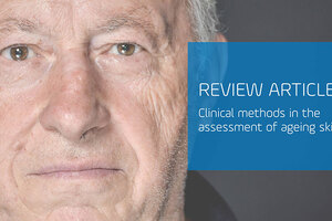 Clinical methods in the assessment of ageing skin