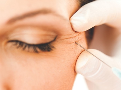Cosmetic Procedures Market Report: The key trends driving global growth in 2017