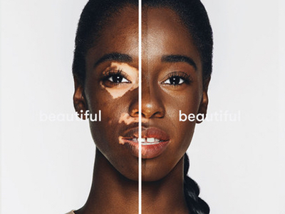 Dermablend debuts #beautifulbeautiful project