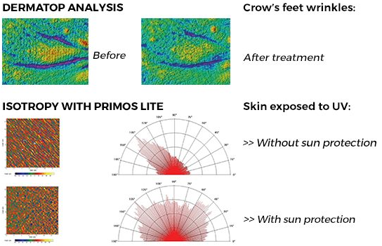 Dermscan discusses photoageing and how to assess it