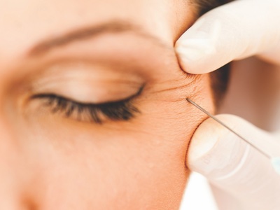 Divorce drives 14% of women to have anti-wrinkle injectables
