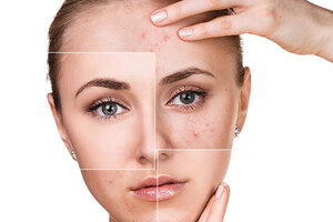 Don’t settle. More research needs to be done on the microbiome skin care