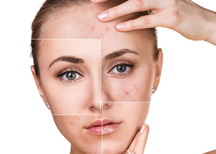 Don’t settle. More research needs to be done on the microbiome skin care