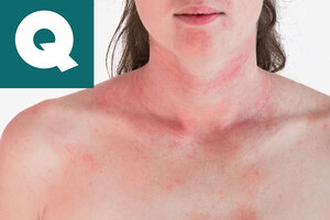 Embrace the solution: Full Allergen Testing for Cosmetics