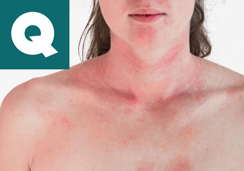 Embrace the solution: Full Allergen Testing for Cosmetics