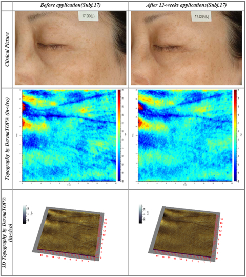 EMortal: the Stem Cell Booster