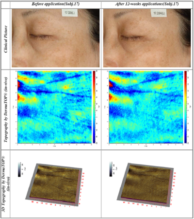 EMortal: the Stem Cell Booster