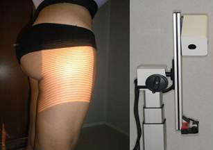 Eurofins' efficacy tests on cellulite