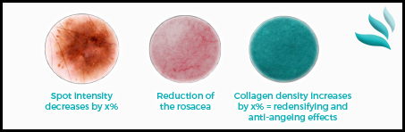 Evaluation of Hemoglobin, Melanin and Collagen Rate