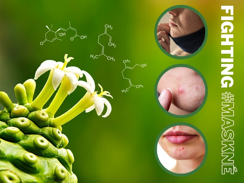 Facing maskne with plant stem cell technology: A Quorum Quenching story