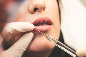 Fake injectable dermal fillers: A dangerous trend in the beauty industry 