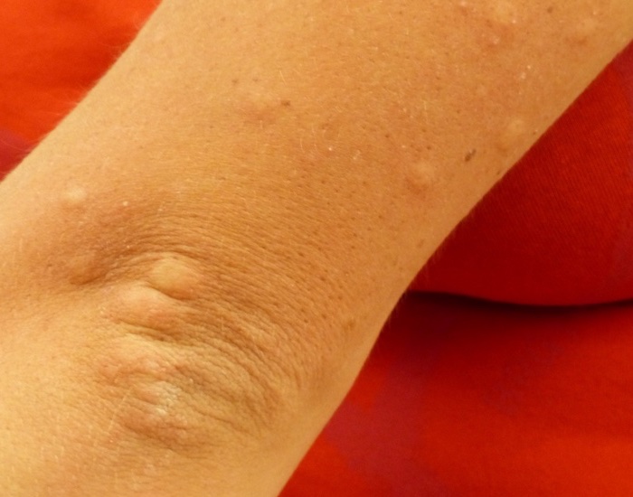 FDA launches nationwide allergen survey to help determine what causes irritation and reactions