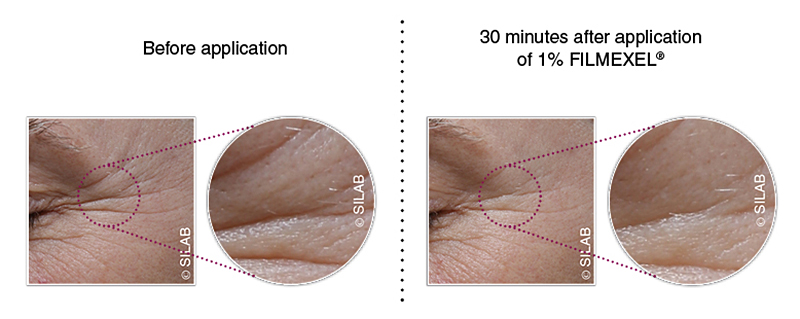 FILMEXEL: The excellence of a natural, protective and lifting film
