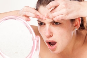 Five ways to help prevent adult acne