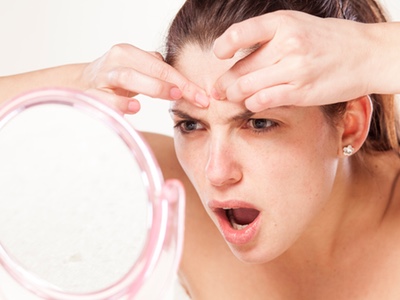 Five ways to help prevent adult acne