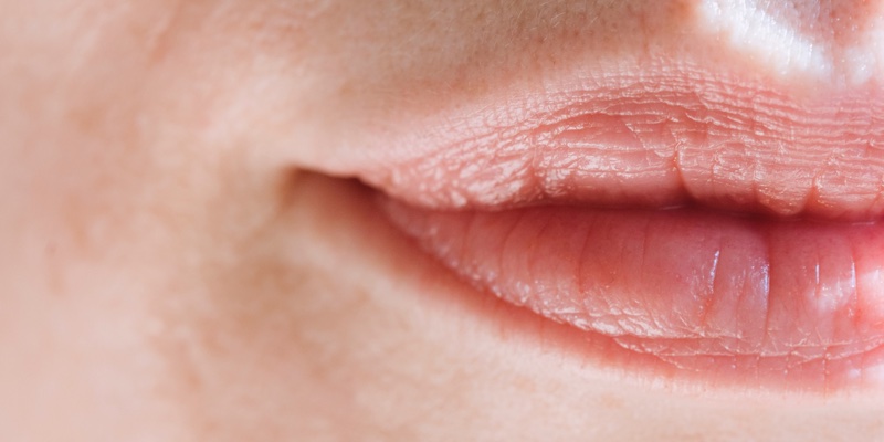Galderma debuts first-of-its-kind expert community for sensitive skins