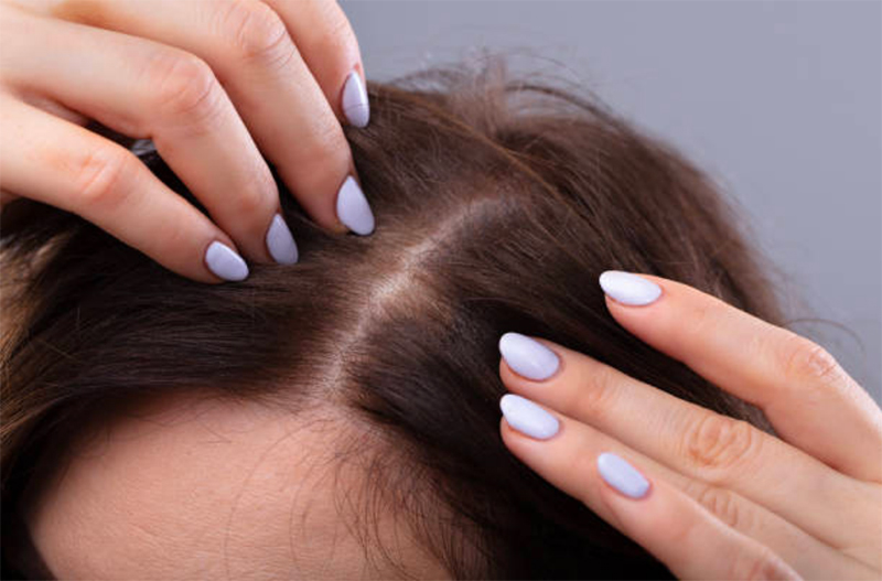 Hairburst helps over-35s with hair loss