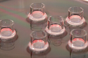 Henkel acquires epiCS skin model technology from SkinInVitro
